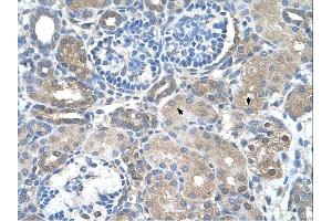 SARDH antibody was used for immunohistochemistry at a concentration of 4-8 ug/ml.