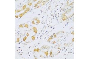 Immunohistochemistry of paraffin-embedded human stomach using FDXR antibody (ABIN5972045) at dilution of 1/100 (40x lens). (Ferredoxin Reductase Antikörper)