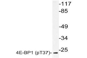 Western blot (WB) analyzes of p-4E-BP1 (pThr37) antibody in extracts from MDA-MB-435 EGF cells. (eIF4EBP1 Antikörper  (pThr37))