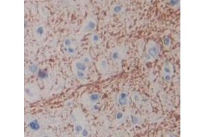 IHC-P analysis of Human Tissue, with DAB staining. (CPZ Antikörper  (AA 425-652))