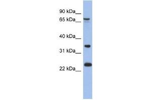 TBC1D25 antibody used at 1 ug/ml to detect target protein.