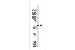 Image no. 1 for anti-beta-Site APP-Cleaving Enzyme 2 (BACE2) (C-Term), (Isoform C) antibody (ABIN358586) (BACE2 Antikörper  (C-Term, Isoform C))