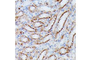 Immunohistochemistry of paraffin-embedded rat kidney using IDH3A antibody (ABIN7268029) at dilution of 1:100 (40x lens). (IDH3A Antikörper  (AA 28-366))