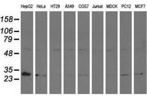 Western blot analysis of extracts (35 µg) from 9 different cell lines by using anti-AK3 monoclonal antibody. (Adenylate Kinase 3 Antikörper)