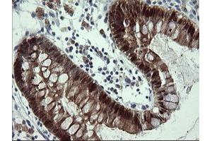 Image no. 5 for anti-Cytidine Monophosphate (UMP-CMP) Kinase 1, Cytosolic (CMPK1) antibody (ABIN1497544) (Cytidine Monophosphate (UMP-CMP) Kinase 1, Cytosolic (CMPK1) Antikörper)