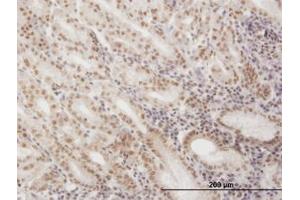 Image no. 1 for anti-Small Nuclear RNA Activating Complex, Polypeptide 4, 190kDa (SNAPC4) (AA 53-163) antibody (ABIN598934) (SNAPC4 Antikörper  (AA 53-163))