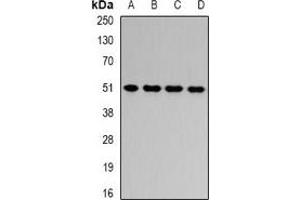 Western blot analysis of HADHB expression in HepG2 (A), Jurkat (B), mouse liver (C), rat liver (D) whole cell lysates. (HADHB Antikörper)