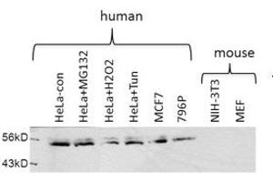 USP30 antibody - middle region  validated by WB using Hela cell lysate (Usp30 Antikörper  (Middle Region))