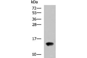 Western blot analysis of Rat kidney tissue lysate using FAM19A4 Polyclonal Antibody at dilution of 1:650 (FAM19A4 Antikörper)