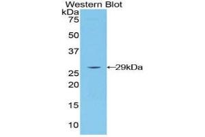 Western Blotting (WB) image for anti-Lymphocyte-Activation Gene 3 (LAG3) (AA 274-504) antibody (ABIN1859591)