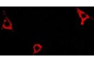 Immunofluorescent analysis of Asparagine Synthetase staining in A549 cells. (Asparagine Synthetase Antikörper)