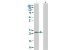 Lane 1: MGMT transfected lysate ( 22. (MGMT 293T Cell Transient Overexpression Lysate(Denatured))