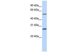 RNF217 antibody  (C-Term)