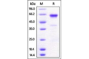 Mouse 4-1BB, Fc Tag on SDS-PAGE under reducing (R) condition. (CD137 Protein (AA 24-211) (Fc Tag))
