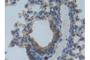 Detection of MYO1A in Mouse Lung Tissue using Polyclonal Antibody to Myosin IA (MYO1A) (Myosin IA Antikörper  (AA 783-1043))