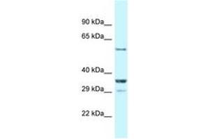 Image no. 1 for anti-Cas-Br-M (Murine) Ecotropic Retroviral Transforming Sequence-Like 1 (CBLL1) (AA 413-462) antibody (ABIN6747715) (CBLL1 Antikörper  (AA 413-462))