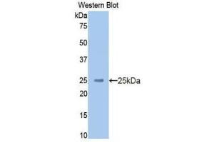 Western Blotting (WB) image for anti-Kininogen (High Molecular Weight) (AA 225-407) antibody (ABIN1859236) (Kininogen (HMW) Antikörper  (AA 225-407))