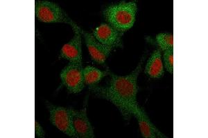 Immunofluorescence staining of U87MG cells using CD73 Mouse Monoclonal Antibody (NT5E/2503) followed by goat anti-Mouse IgG conjugated to CF488 (green). (CD73 Antikörper)