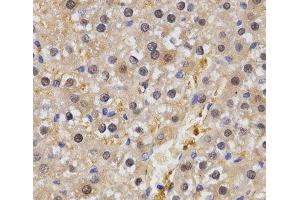Immunohistochemistry of paraffin-embedded Rat liver using HSF2 Polyclonal Antibody at dilution of 1:200 (40x lens). (HSF2 Antikörper)