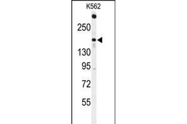 TNK2 Antikörper  (N-Term)