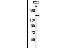 TNK2 Antikörper  (N-Term)
