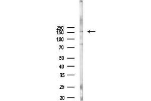 Western blot analysis of lysates from Hela cells(heat-shock,45 min treatment), using Phospho-APC (Ser2054) Antibody at 1/1000 dilution.