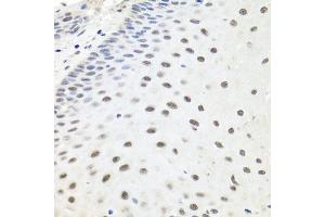 Immunohistochemistry of paraffin-embedded human esophagus using EXO1 antibody (ABIN6129824, ABIN6140356, ABIN6140357 and ABIN6219087) at dilution of 1:100 (40x lens). (Exonuclease 1 Antikörper  (AA 601-846))