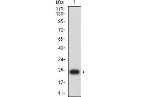 Western blot analysis using S100B mAb against human S100B (AA: 1-92) recombinant protein. (S100B Antikörper  (AA 1-92))