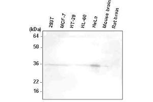 The extracts of 293T, MCF7, HT-29, HL-60, HeLa, mouse brain, and rat brain were resolved by SDS-PAGE, transferred to PVDF membrane and probed with anti-human HtrA2/Omi antibody (1:1,000). (HTRA2 Antikörper  (AA 134-458))