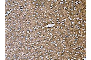 IHC analysis of SYP using anti-SYP antibody (ABIN7603120). (Synaptophysin Antikörper  (N-Term))