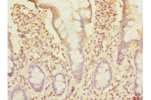 Immunohistochemistry of paraffin-embedded human small intestine tissue using ABIN7171247 at dilution of 1:100 (Syntaxin 7 Antikörper  (AA 1-170))