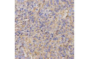 Immunohistochemistry (IHC) image for anti-Glycoprotein IX (Platelet) (GP9) antibody (ABIN1876562) (CD42a Antikörper)