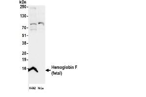 anti-Fetal Hemoglobin (HbF) antibody (HRP)