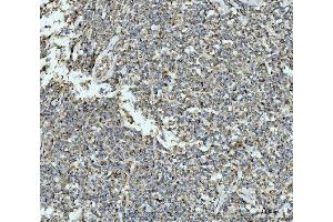 IHC analysis of ECSIT using anti-ECSIT antibody (ABIN7602543). (ECSIT Antikörper  (AA 83-339))