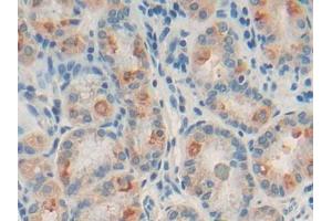 DAB staining on IHC-P; Samples: Human Stomach Tissue (CD22 Antikörper  (AA 28-246))