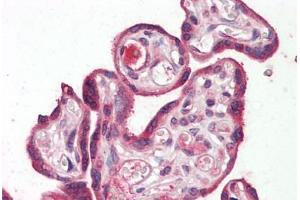 Human Placenta: Formalin-Fixed, Paraffin-Embedded (FFPE) (RILPL2 Antikörper  (Internal Region))