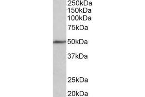 Western Blotting (WB) image for anti-Cell Adhesion Molecule 1 (CADM1) (AA 125-137) antibody (ABIN1100375) (CADM1 Antikörper  (AA 125-137))