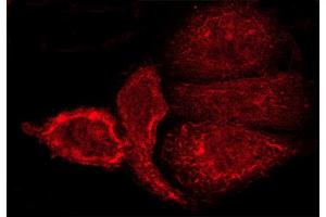 ABIN6268791 staining A-431 cells by ICC/IF.