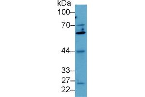 Detection of Smad4 in Human MCF7 cell lysate using Polyclonal Antibody to Mothers Against Decapentaplegic Homolog 4 (Smad4) (SMAD4 Antikörper  (AA 9-231))