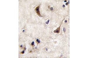 Immunohistochemistry (Paraffin-embedded Sections) (IHC (p)) image for anti-Protein tyrosine Phosphatase, Non-Receptor Type 5 (Striatum-Enriched) (PTPN5) (AA 168-198), (N-Term) antibody (ABIN392843)