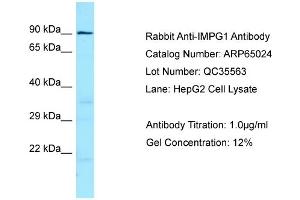 Western Blotting (WB) image for anti-Interphotoreceptor Matrix Proteoglycan 1 (IMPG1) (C-Term) antibody (ABIN2790023) (IMPG1 Antikörper  (C-Term))