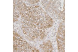 Immunohistochemistry (IHC) image for anti-Ribosomal Protein S3A (RPS3A) (AA 1-50) antibody (ABIN7455060) (RPS3A Antikörper  (AA 1-50))