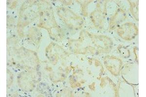 Immunohistochemistry of paraffin-embedded human kidney tissue using ABIN7173555 at dilution of 1:100 (TMOD3 Antikörper  (AA 1-352))