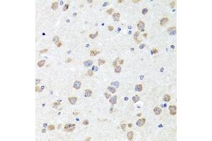 Immunohistochemistry of paraffin-embedded mouse brain using CHD1 antibody (ABIN6133620, ABIN6138500, ABIN6138501 and ABIN7101818) at dilution of 1:100 (40x lens).