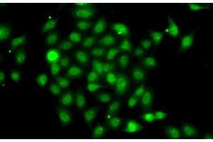 Immunofluorescence analysis of A-549 cells using COPS2 Polyclonal Antibody (COPS2 Antikörper)
