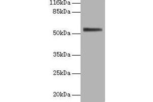 Western blot All lanes: ALPI antibody at 2 μg/mL + 293T whole cell lysate Secondary Goat polyclonal to rabbit IgG at 1/10000 dilution Predicted band size: 57 kDa Observed band size: 57 kDa (Intestinal Alkaline Phosphatase Antikörper  (AA 26-500))
