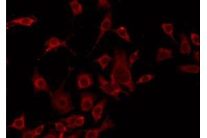 ABIN6275247 staining HeLa by IF/ICC. (TOMM20 Antikörper  (Internal Region))