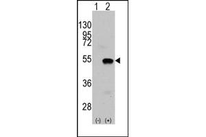Image no. 1 for anti-SET and MYND Domain Containing 2a (SMYD2A) (N-Term) antibody (ABIN356582) (SMYD2A Antikörper  (N-Term))