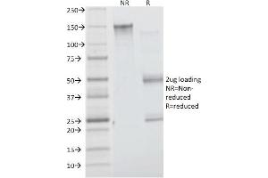 SDS-PAGE Analysis Purified Insulin Receptor Mouse Monoclonal Antibody (INSR/1661). (Insulin Receptor Antikörper  (Extracellular Domain))