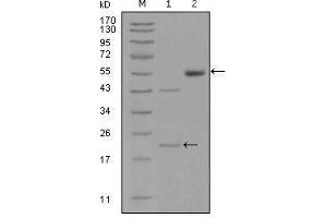 Western Blot showing EPHA5 antibody used against truncated EPHA5-His recombinant protein (1) and truncated EPHA5 (aa620-774)-hIgGFc transfected CHO-K1 cell lysate (2). (EPH Receptor A5 Antikörper  (AA 620-774))